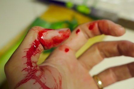 En hand med färskt blod på fingrar och handflata, troligen från ett sår.